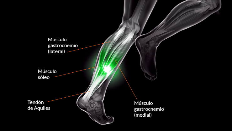 dolor muscular en la pantorrilla detrás de la pierna